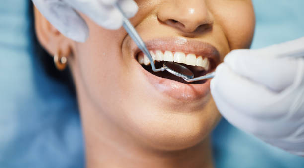 Best Emergency Dentist for Lost Fillings or Crowns in Deerfield, MI