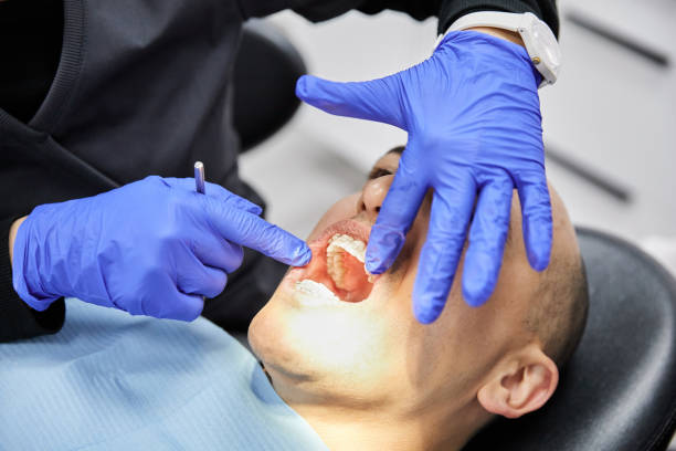 Best Emergency Dental Extractions in Deerfield, MI