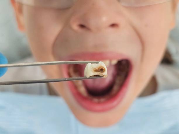Best Emergency Dental Services for Seniors in Deerfield, MI